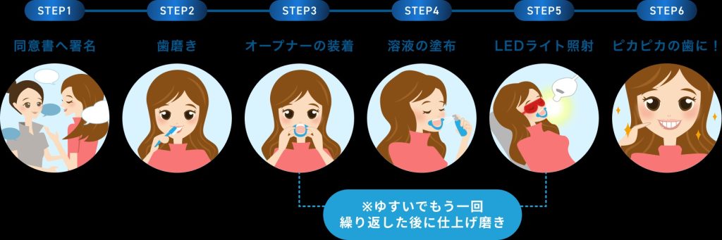 ホワイトニング手順